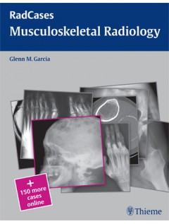 Musculoskeletal Radiology