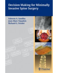 Decision Making for Minimally Invasive Spine Surgery