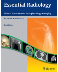 Essential Radiology