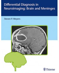 Differential Diagnosis in Neuroimaging