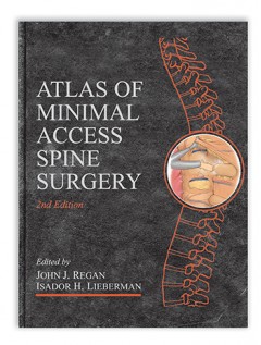 Atlas of Minimal Access Spine Surgery, Second Edition