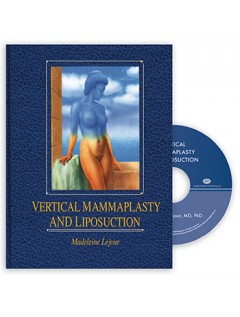 Vertical Mammaplasty and Liposuction