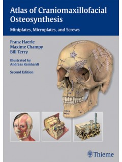 Atlas of Craniomaxillofacial Osteosynthesis