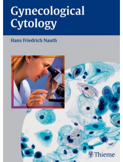 Gynecologic Cytology