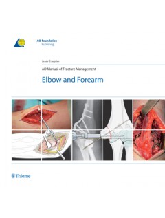 AO Manual of Fracture Management: Elbow & Forearm