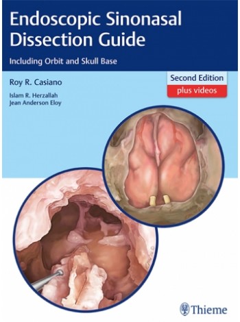 Endoscopic Sinonasal Dissection Guide - Indian Reprint