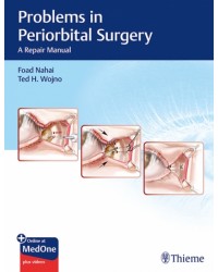Problems in Periorbital Surgery 