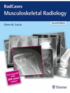RadCases Musculoskeletal Radiology