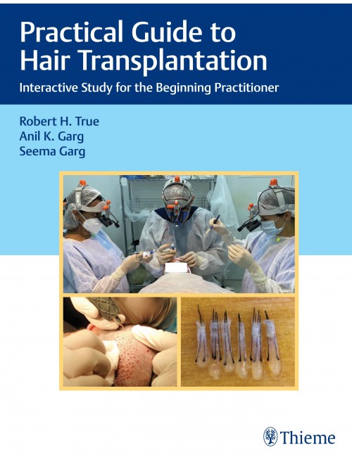 Plastic Surgery | Practical Guide to Hair Transplantation: Interactive  Study for the Beginning Practitioner